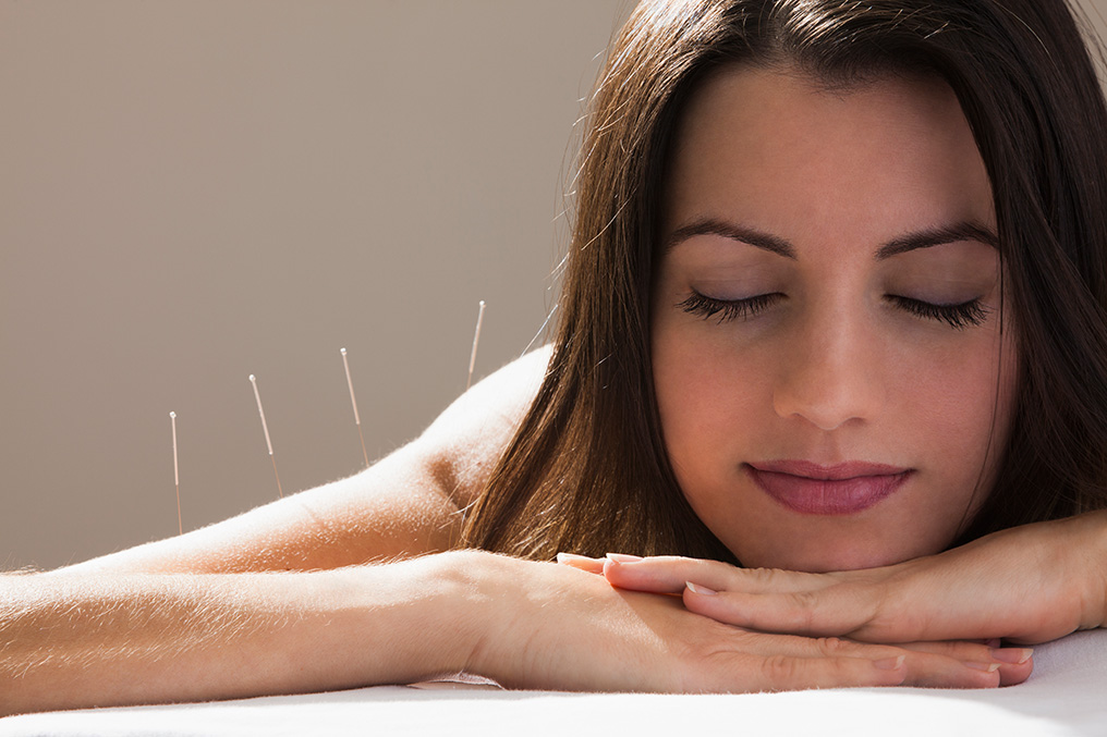 Frau macht Akupunktur